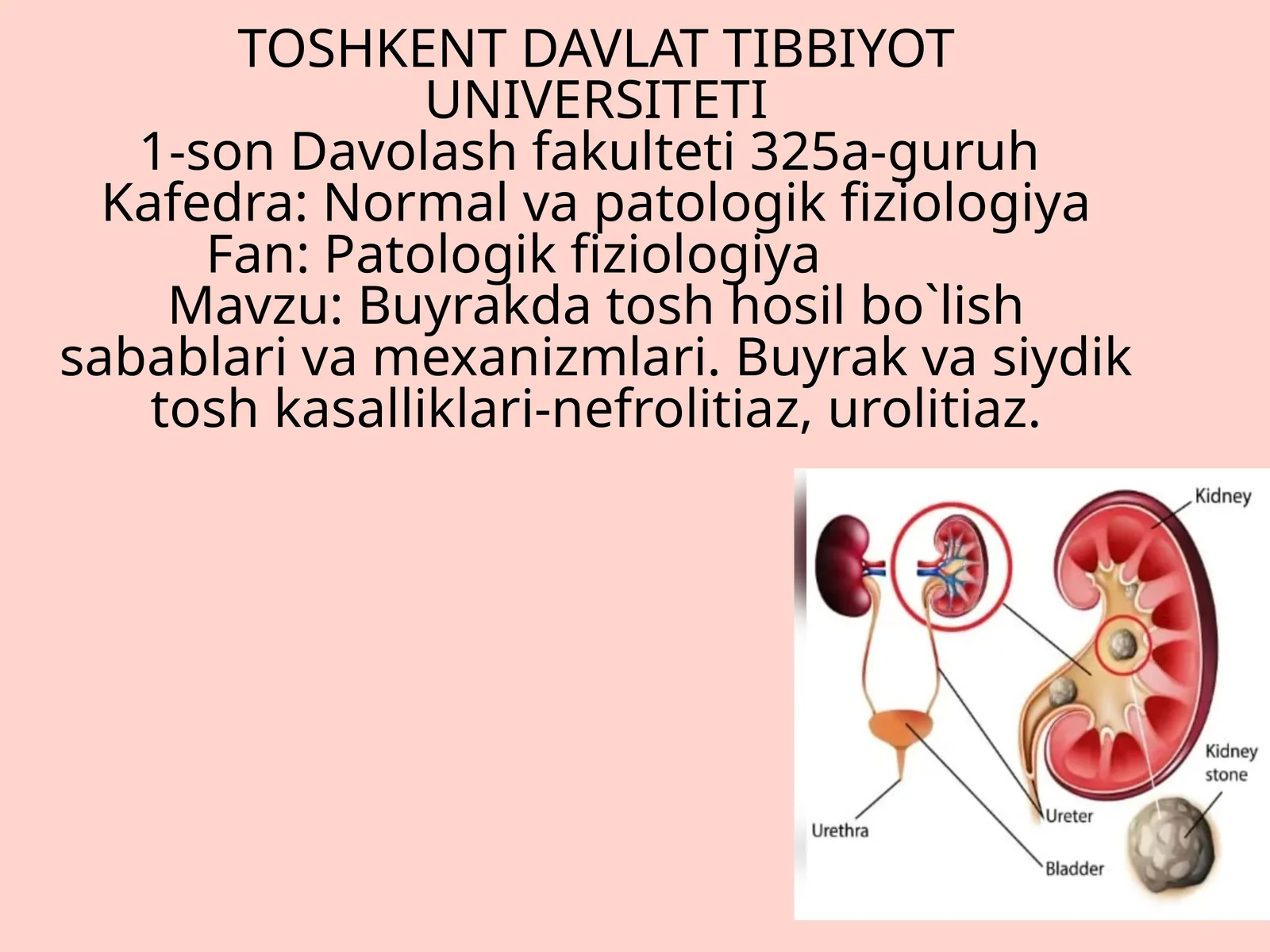 Buyrak tosh kasalligi hosil boʻlishi sabablari, klinikasi, davolash usullari